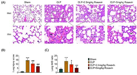 Rosavin Alleviates Sepsis Induced Lung Injury A Lung Tissues From