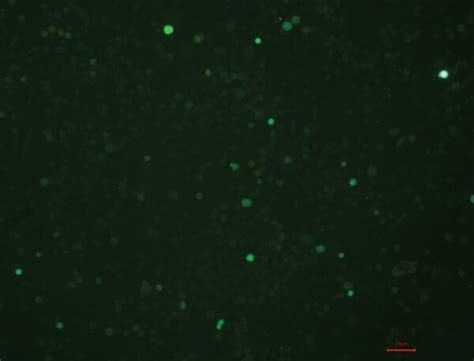 Effect Of Puerarin On Corticosterone Induced ROS Generation In PC12