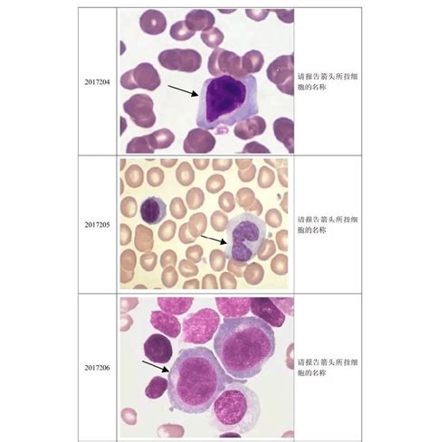 2017 年第2次血细胞形态学检查室间质量评价【参考答案】word文档在线阅读与下载免费文档