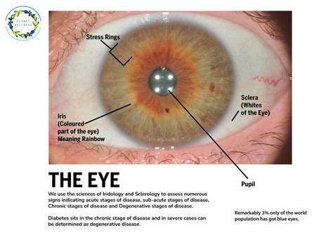 Discover The Fascinating World Of Iridology Pictures And Meanings