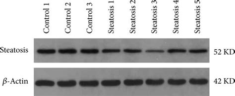 Characteristics of circRNA 0046367 miR 34a PPARα regulatory system in