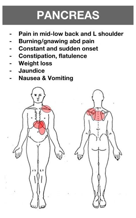 Visceral Pain Referral — Snapspt 👻