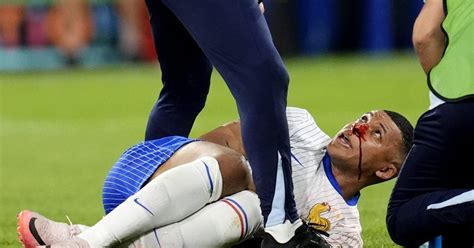 Blessure De Kylian Mbappé La Fédération Française De Football Fait Le