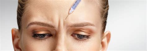 Zornesfalte Klinik Am Rhein Schonende Faltenbehandlung Mit Botox