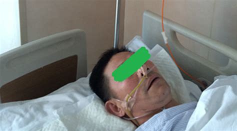 photo   patient     onset  stupor  patient fell