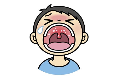 ヘルパンギーナの感染経路・症状・潜伏期間を解説！大人もうつる？ | コラム | 【公式】豊島医院 | 秋田県大仙市の内科・小児科