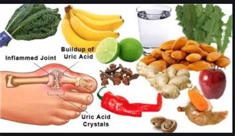 Uric Acid 84 Good Or Bad