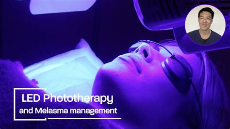 Does LED Phototherapy Work Melasma Dr Davin Lim YouTube