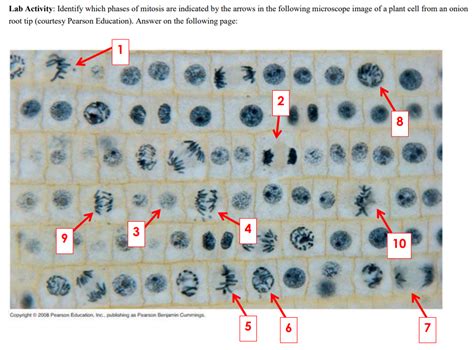 Stages Of Mitosis Under Microscope