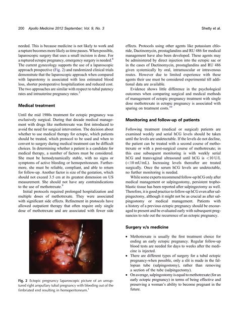 Medical Management of Ectopic Pregnancy | PDF