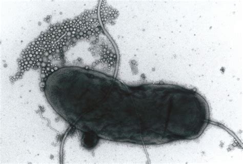 Membrane vesicles released by bacteria may play different roles during infection