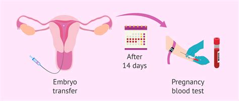 When To Take A Pregnancy Test After Ivf