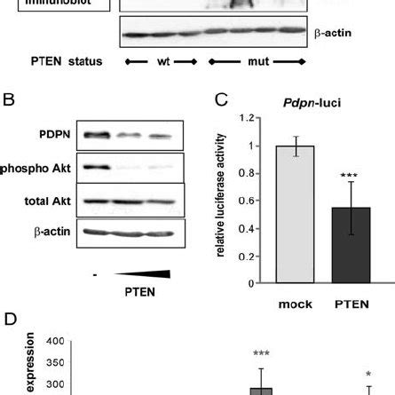 Epigenetic Regulation Of PDPN Expression In Human Glioma Samples And