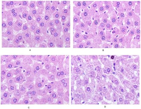 Photomicrographs Of Liver Tissues He6200 Download Scientific