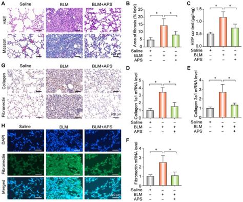 APS Attenuated BLM Induced Pulmonary Fibrosis In Mice A Histological