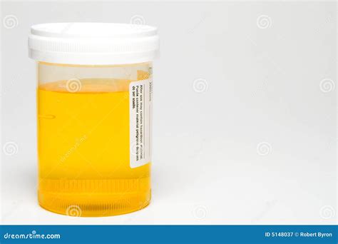 urine sample stock image image  random examine test