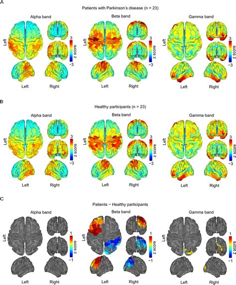 Cortical Power During The Resting State The Normalized Power Of 3