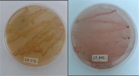 Agar Salmonella Shigella A Y Agar Macconkey B Utilizados Para El