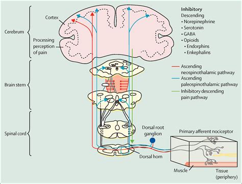 Pain In The Joints And Beyond The Challenge Of Rheumatoid Arthritis