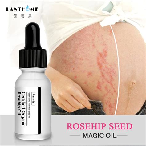 Pansly Rosehip Oil Pregnancy Scar Remove Essential Oils Remove Stretch