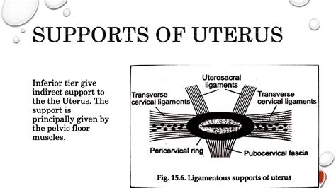 Retroverted Uterus Ppt