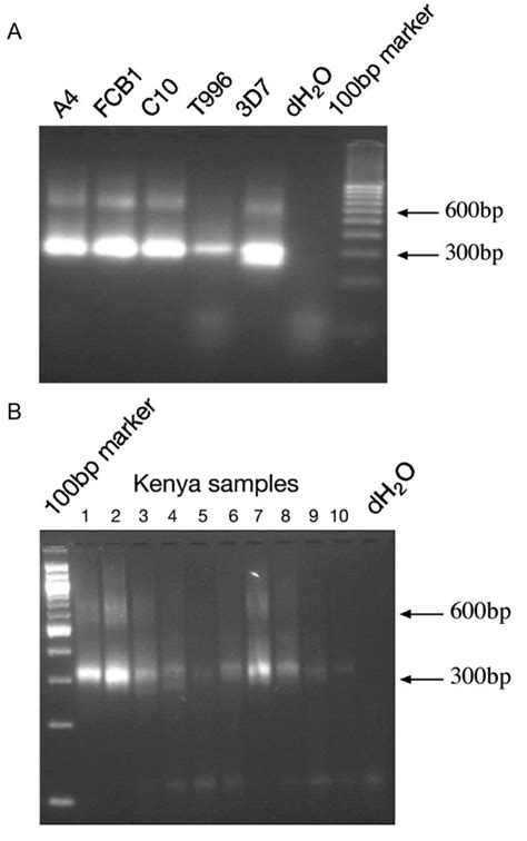 Agarose Gel Showing Pcr Products Obtained From Laboratory Line And