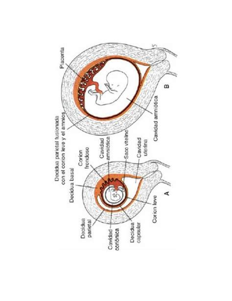 Relaci N De Las Membranas Fetales Crashvin Udocz