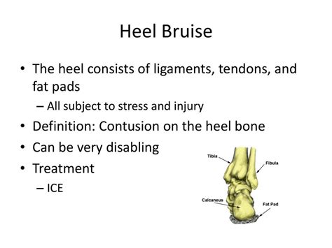 Injuries To The Foot Ppt Download