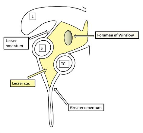 Graphic Illustration Of Lesser Sac And Foramen Of Winslow L Liver