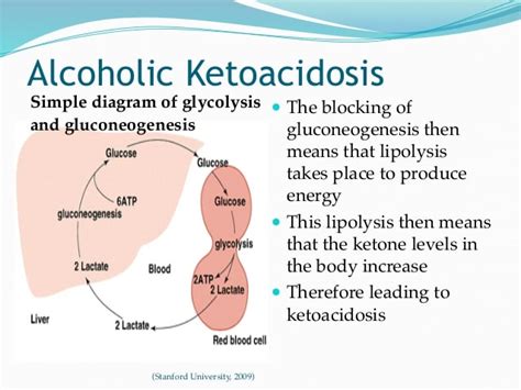 Acidosis And Alcohol