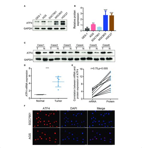 The Expression Of Activating Transcription Factor 4 Atf4 Is