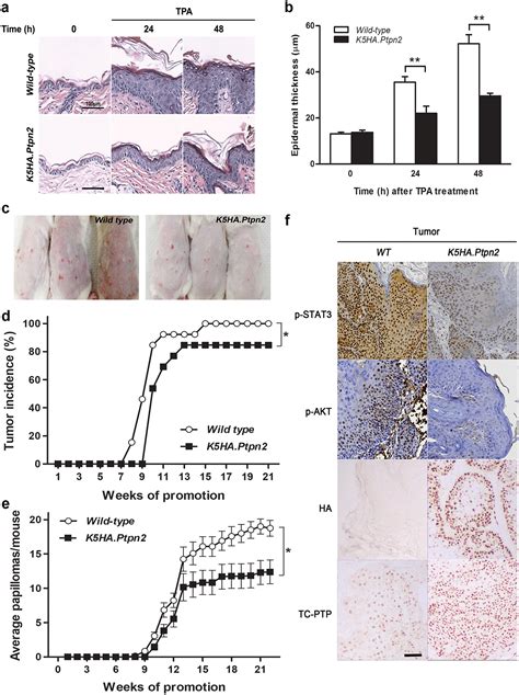 Overexpression Of Tc Ptp In Murine Epidermis Attenuates Skin Tumor