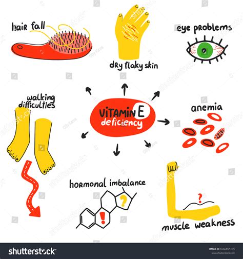 Hand Drawn Vitamin E Tocopherol Deficiency Stock Vector Royalty Free