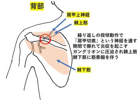 ボールを投げると肩が痛い！なかなか治らない野球肩で困っている選手へ！悪化する前にすぐにでも治療しましょう！ すみだ整骨院 直方飯塚