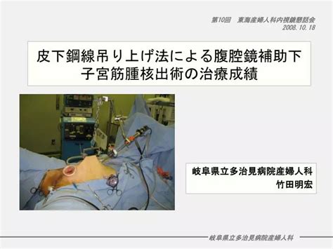 Ppt 皮下鋼線吊り上げ法による腹腔鏡補助下子宮筋腫核出術の治療成績 Powerpoint Presentation Id 5640126