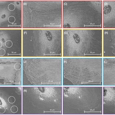 Sem Images Of Actin Filament Structures Of A Single Lung Ec Transfected