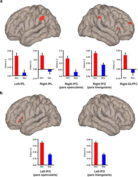 Effects Of Early And Late Bilingualism On Resting State Functional