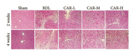 Representative Photomicrographs Of Liver Sections Stained With Hande And