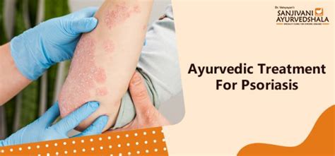 Ayurvedic Treatment For Psoriasis