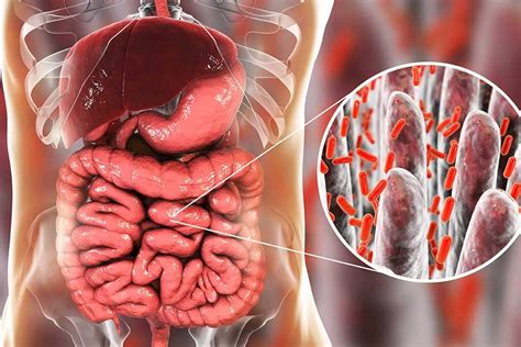 Qu Podemos Comer Para Recuperar La Flora Intestinal Mejor Con Salud