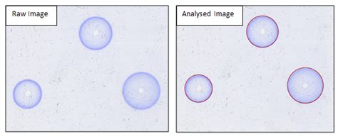 Single Radial Immunodiffusion Srid Synbiosis