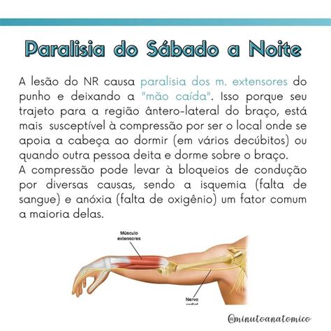Sindrome Do Sabado A Noite - Minuto Anatomoclínico #24: Paralisia do Sábado à noite – Anatomia ...