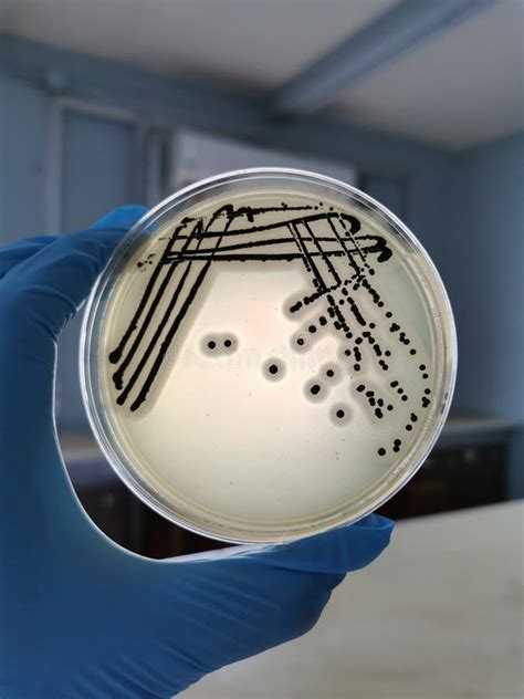 Staphylococcus Aureus On Baird Parker Agar Stock Image Image Of