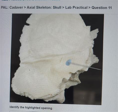 Solved Pal Cadaver Axial Skeleton Skull Lab Practical Chegg