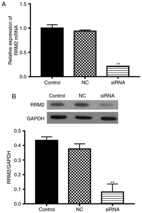 Suppression Of RRM2 Inhibits Cell Proliferation Causes Cell Cycle