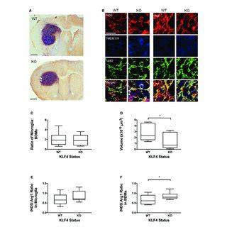 Effect Of KLF4 Knock Out In Myeloid Cells On Phenotype Of