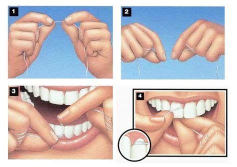 C Mo Usar El Hilo Dental Cl Nica Mu Oz