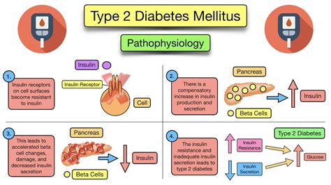 Type 2 Diabetes Pathophysiology Diagram