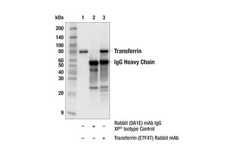 Transferrin E7F4T Rabbit MAb Cell Signaling Technology