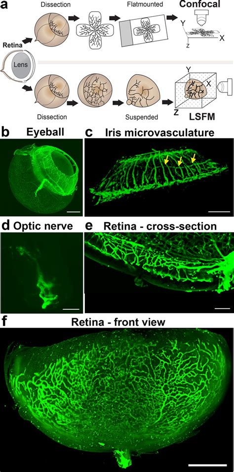 Mouse Retinal Cell Behaviour In Space And Time Using Light Sheet